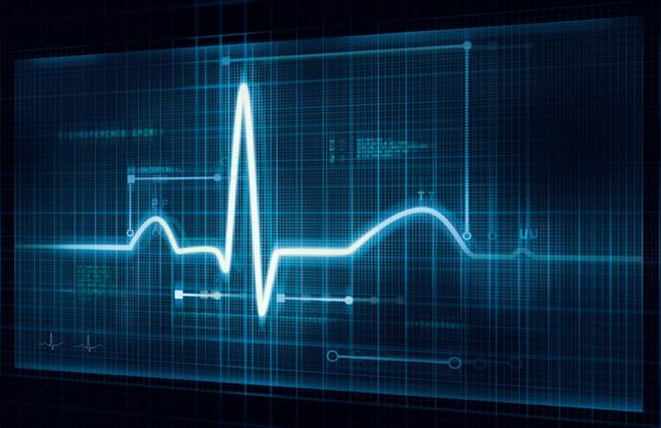 آیا بیماری قلبی با نوار قلب مشخص می شود؟