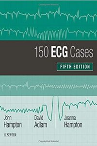ECG-150-Case-اشراقیه-افست-.jpg