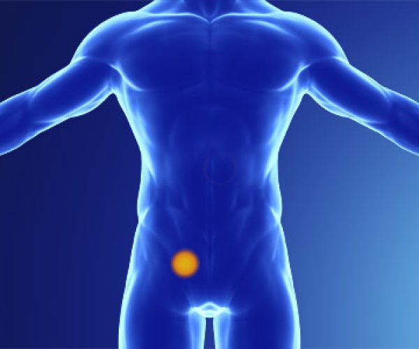 inguinal-hernia.jpg