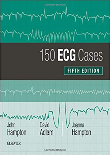 ECG-150-Case-اشراقیه-افست-